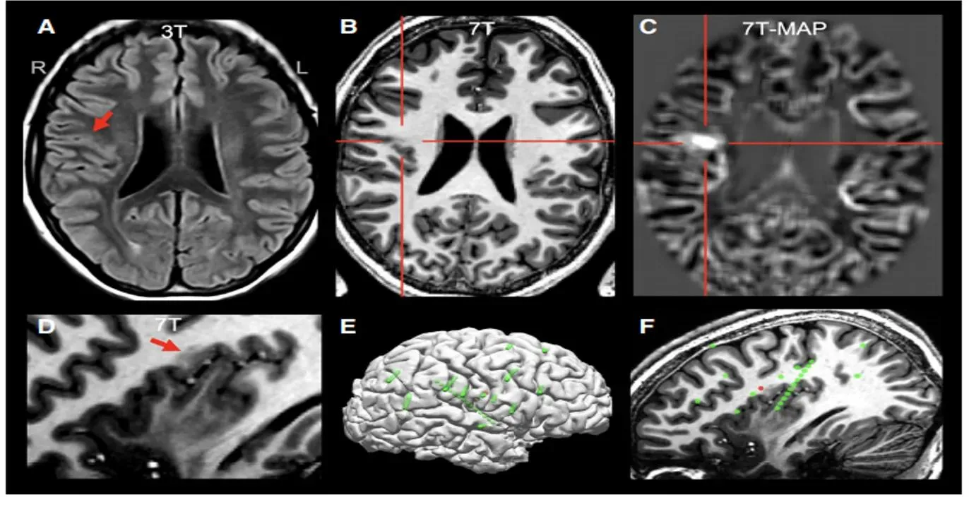 Outpatient Neurological Consultation in Vadodara
